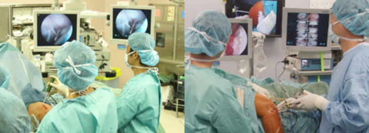 関節鏡・関節鏡視下手術とは：整形外科の専門手術 人工関節手術・関節