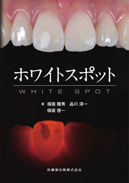 The Tooth Preparation 補綴修復治療の成功を目指した支台歯形成／医歯