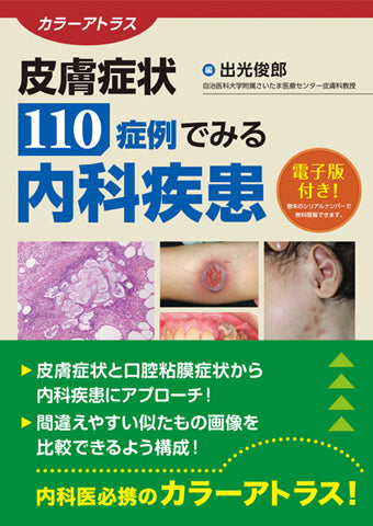 皮膚症状110症例でみる内科疾患【電子版付】 – 日本医事新報社