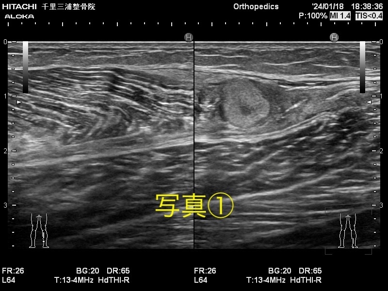 日常生活やスポーツによる体の痛みは、豊中市の三浦整骨院が解決