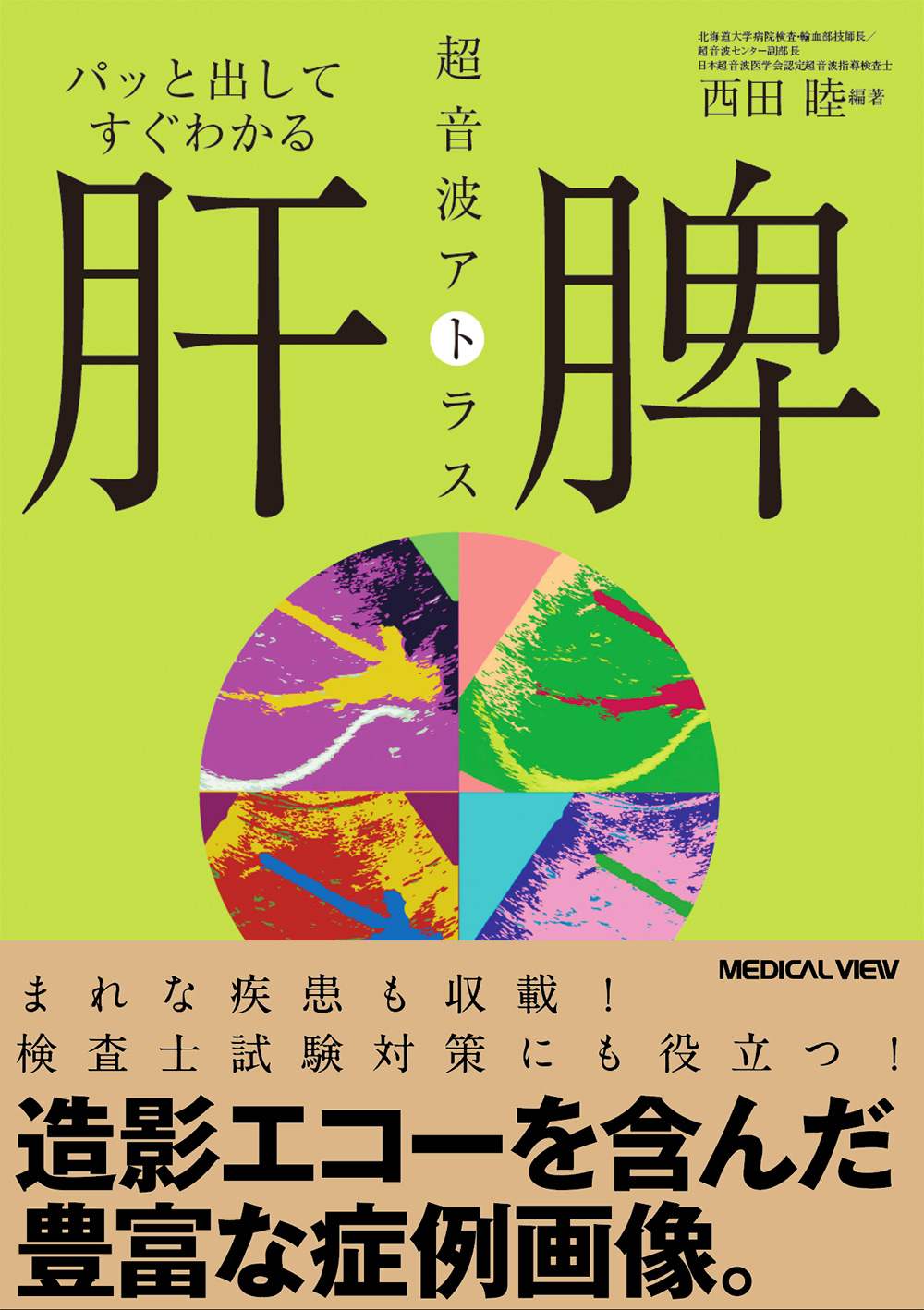メジカルビュー社｜画像医学・放射線医学｜肝・脾 超音波アトラス