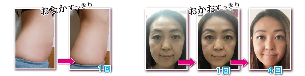 Zero G Free (ゼロジーフリー) | 機能性ローション化粧品