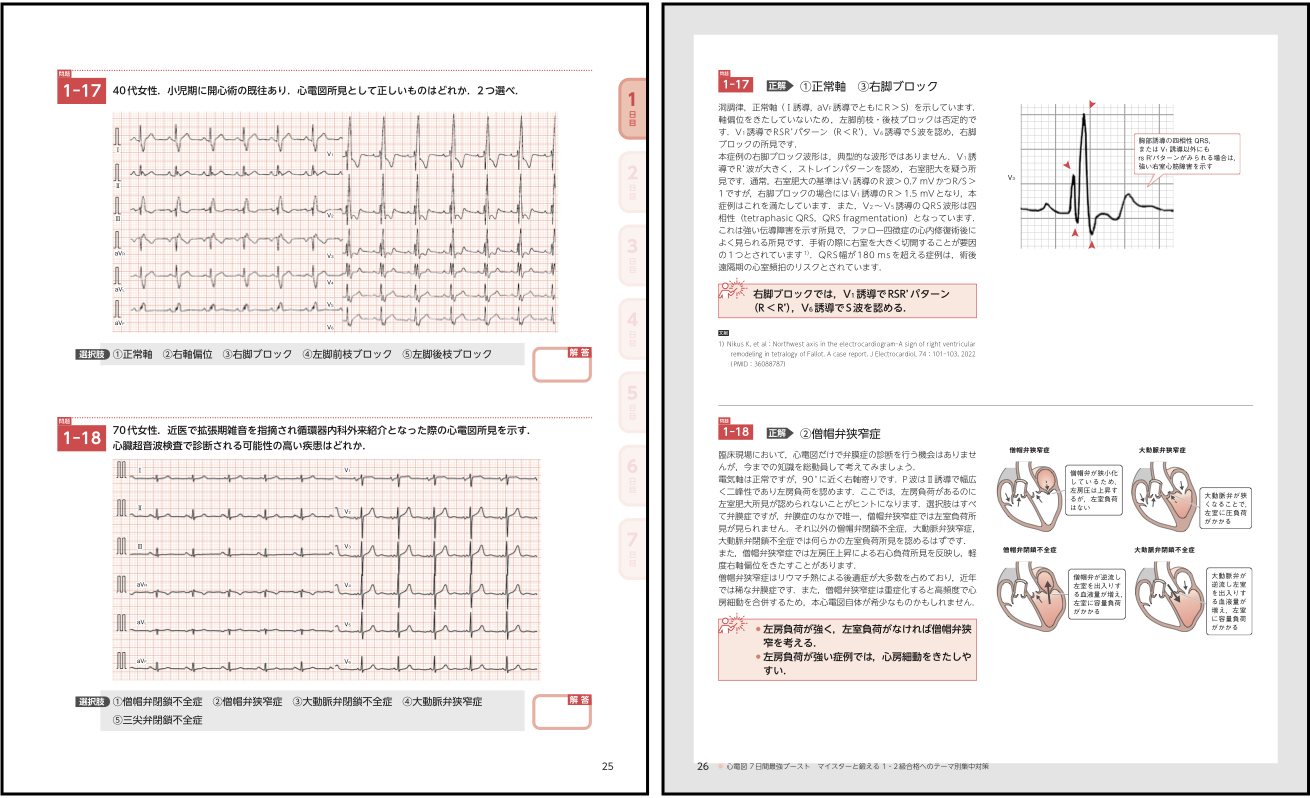 心電図検定1・2級に合格したい方のための 7日間，短期集中