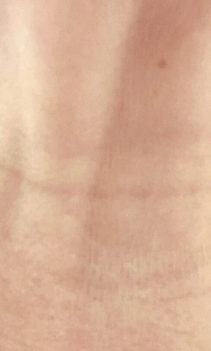 マックビー(MCB)「ポイント・ケアクリーム」 | マックビーのお店【McB