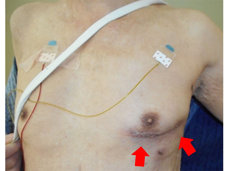 心臓血管外科の診療・活動内容 - 心臓血管センター