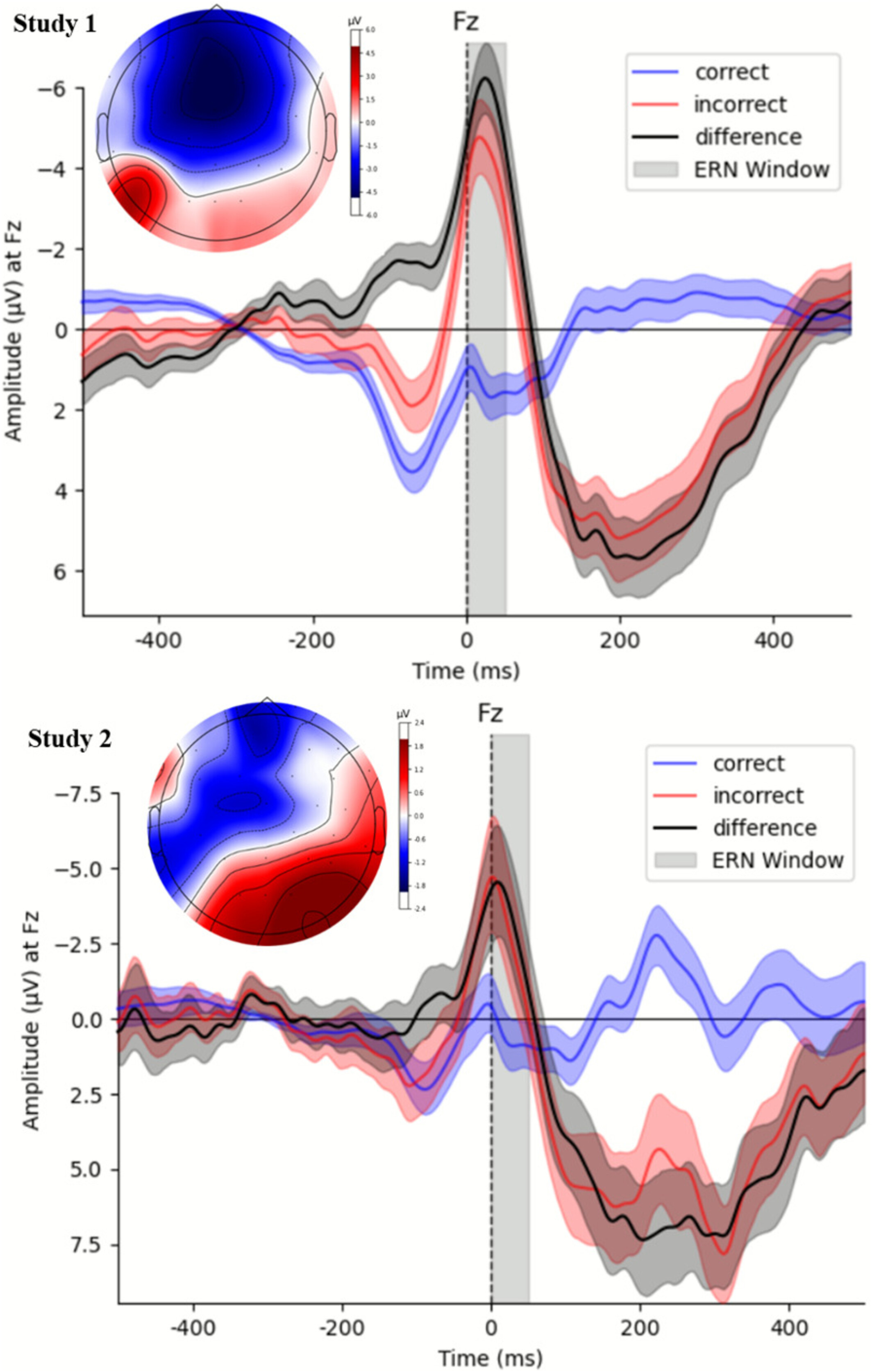 Narcissism: Blunted Error-Related Brain Activity – Surtil :